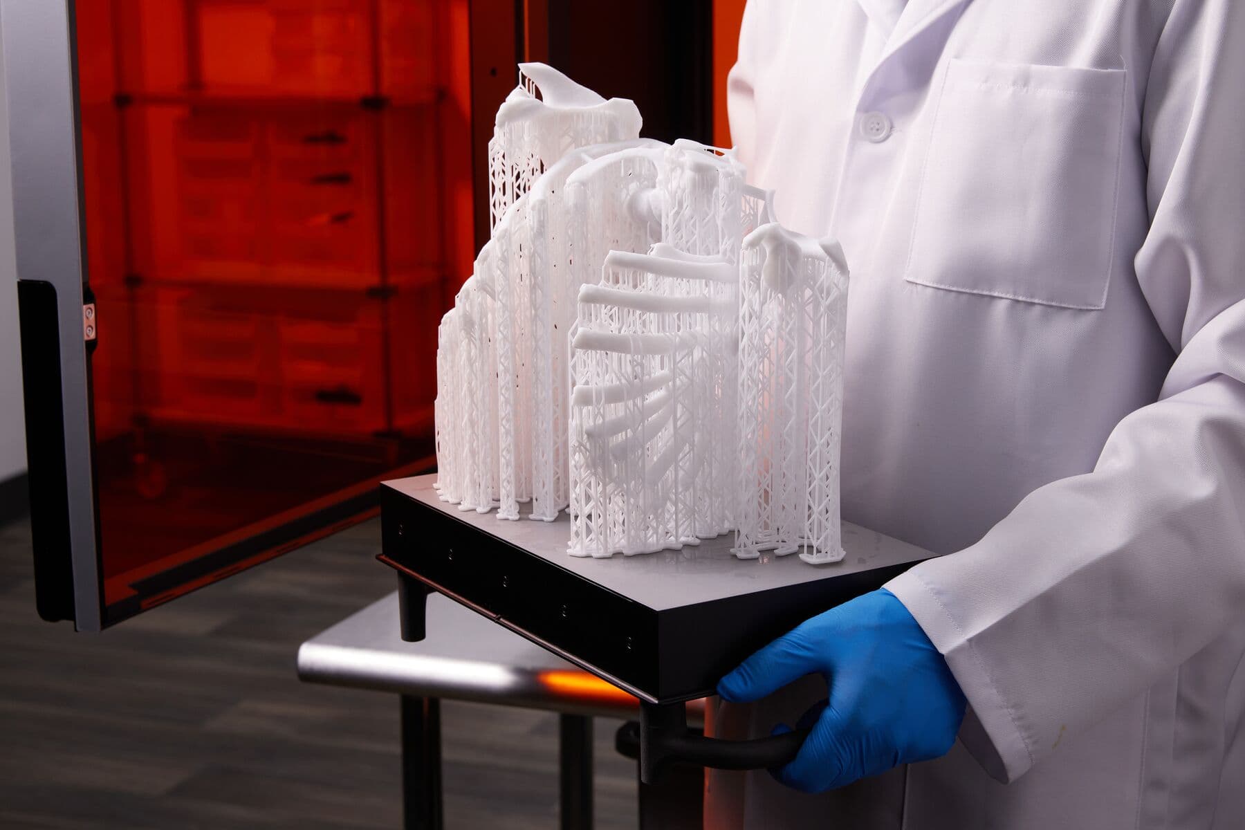 脊柱侧弯的胸腔