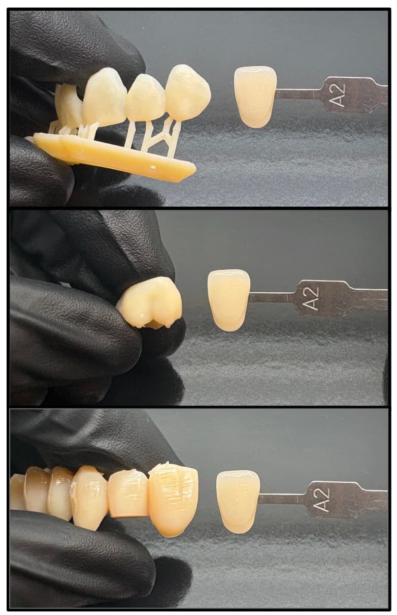 厚度对 Premium Teeth Resin 颜色的影响