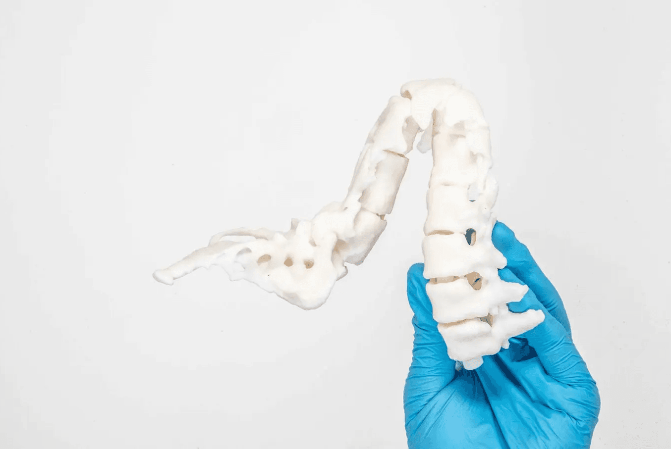 Surgical Model Printed using Formlabs SLA 3D Printers