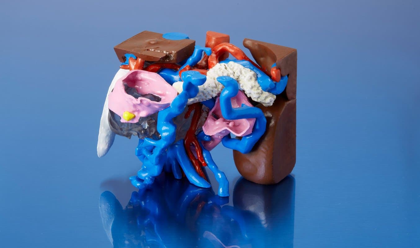 先用 SLA 3D 打印机完成打印,再用丙烯酸进行上色的全彩色胰腺模型。