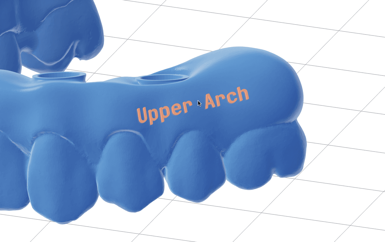 带有标签的 3D 打印牙弓