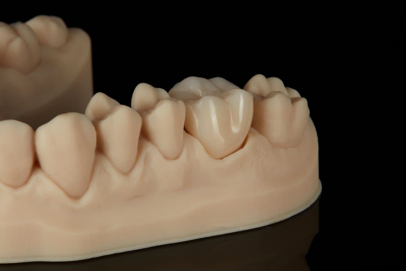 Precision Model Resin 3D 打印牙科模型