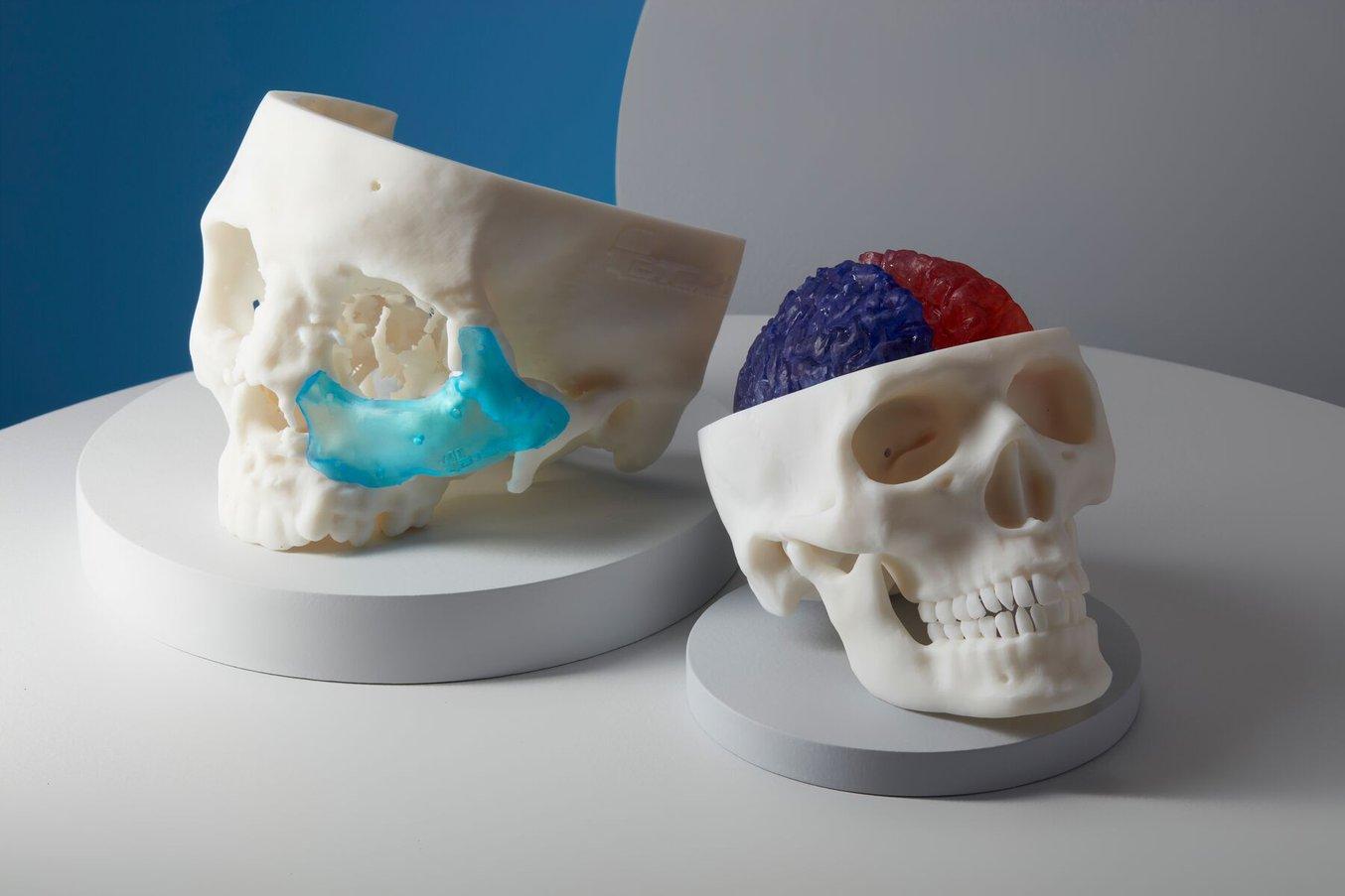 3D printed samples
